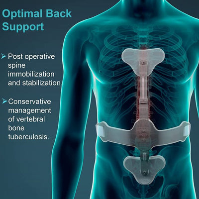 TYNOR A-12 ASH BRACE (HYPER EXTENSION BRACE), SILVER, 1 SET