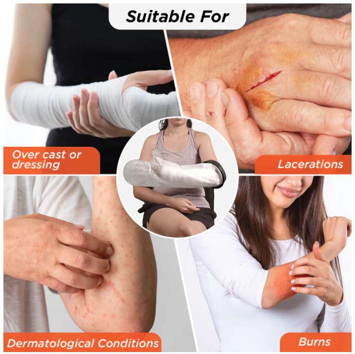 VISSCO CAST COVER ARM (FROM WRIST TO ELBOW) - P.C.NO. 0826