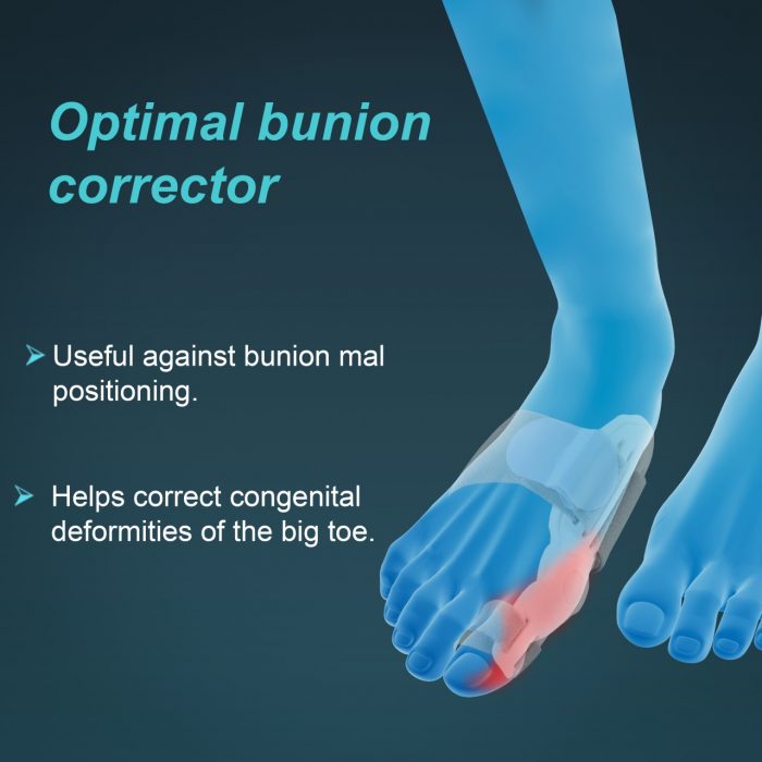 TYNOR K-14 BUNION SPLINT