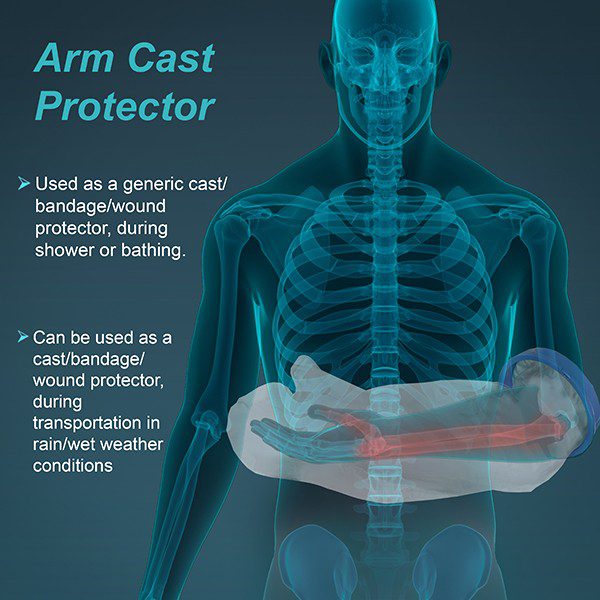 TYNOR C-19 CAST COVER FOR ARM